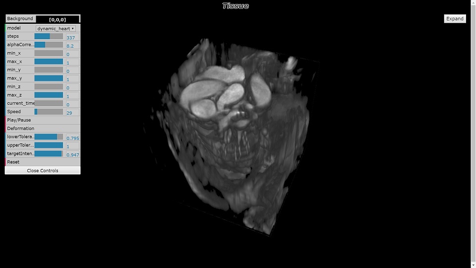 Loading Dynamic MRI